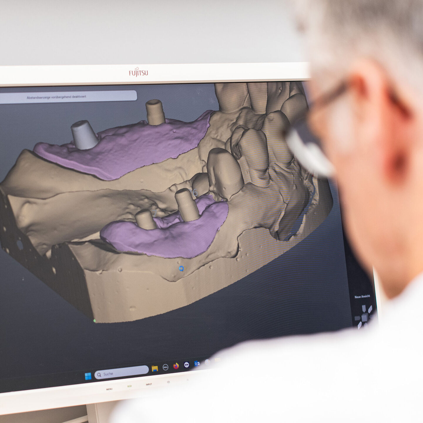 Zahntechniker plant Zahnersatz am Computer