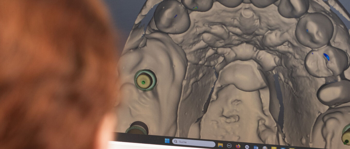 Zahntechnikerin modelliert am Computer Zahnersatz